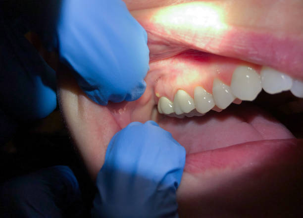 Best Emergency Treatment for Toothache in Coson, OK