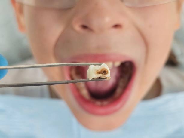 Best 24-Hour Emergency Dentist in Coson, OK